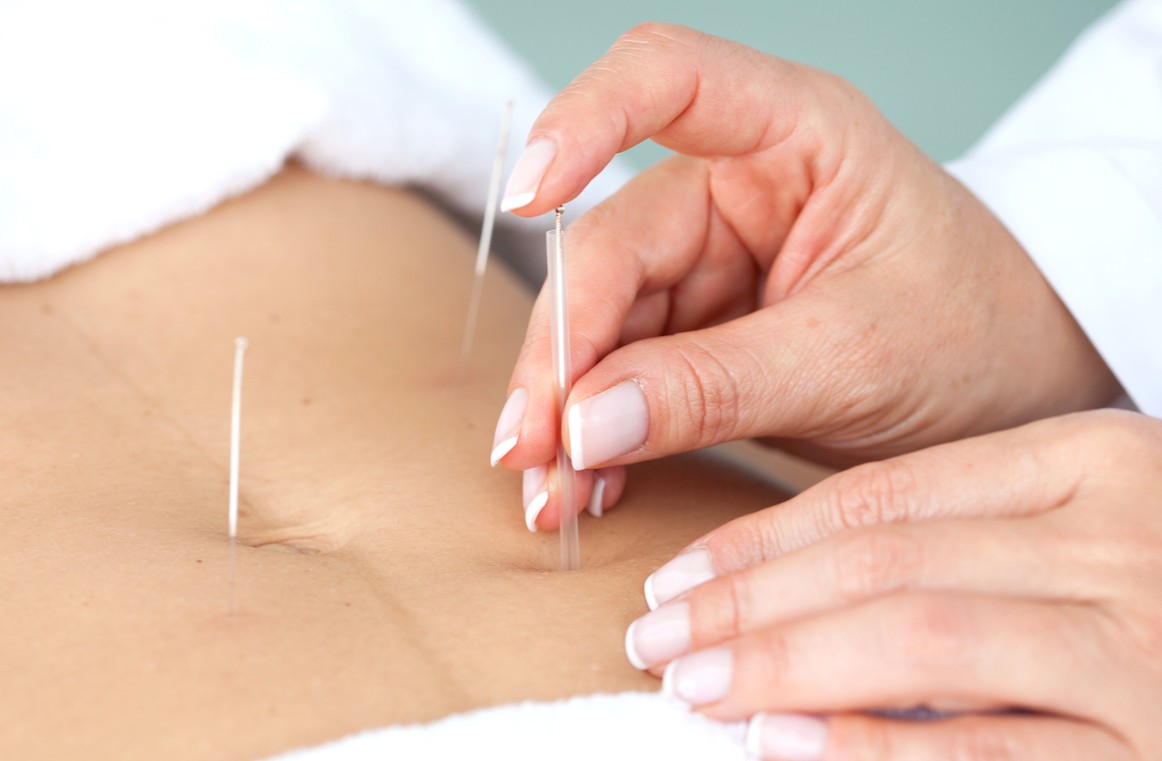 Chart illustrating acupuncture benefits statistics